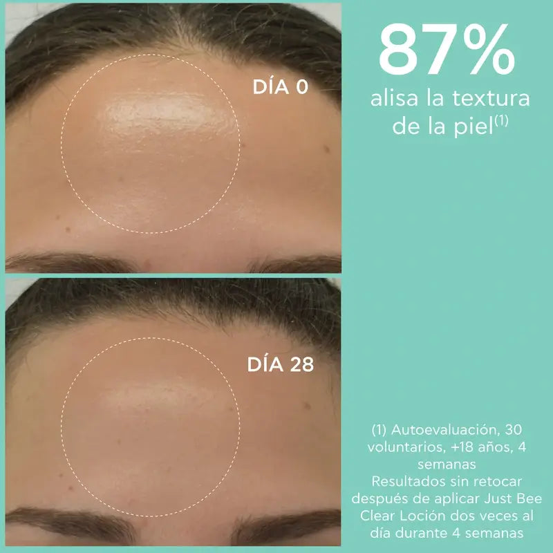 Apivita Just Bee Clear Pore Minimising Purifying Lotion, 200 ml