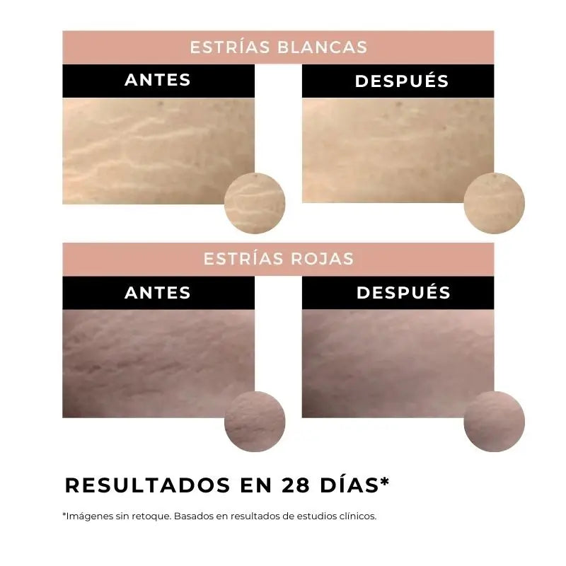 Arganour Body Stretch Mark Cream, 100 Ml