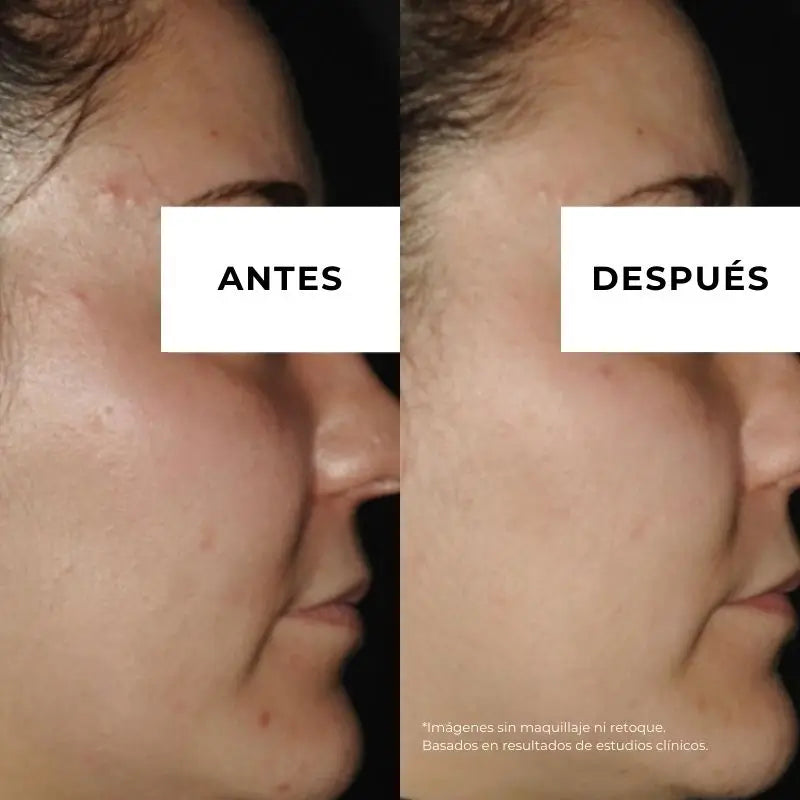 Arganour Facial Equilibrium Anti-Acne Cream, 50 Ml