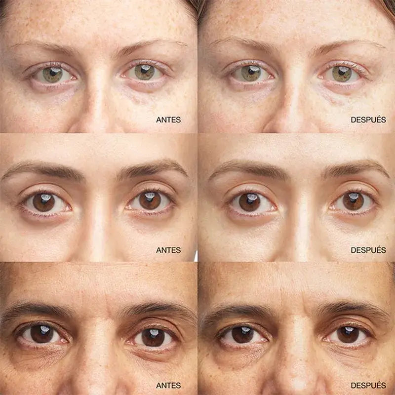 Clinique All About Eyes Illuminating Eye Serum Concentrate, 10 ml