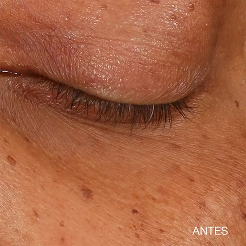 Clinique All About Eyes Illuminating Eye Serum Concentrate, 10 ml