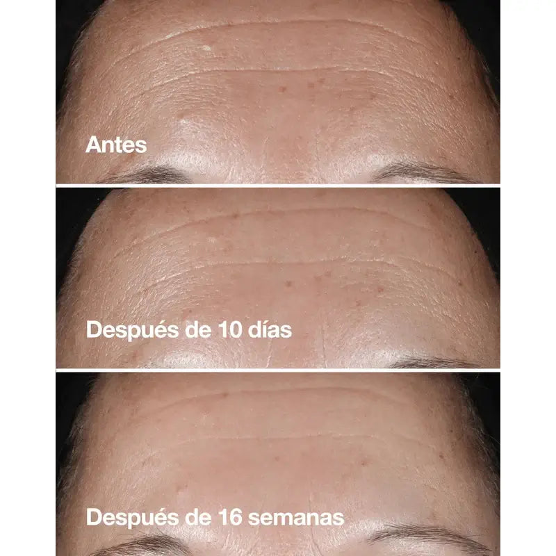 Clinique Smart Serum Anti-Aging Filler and Smoother, 50 ml