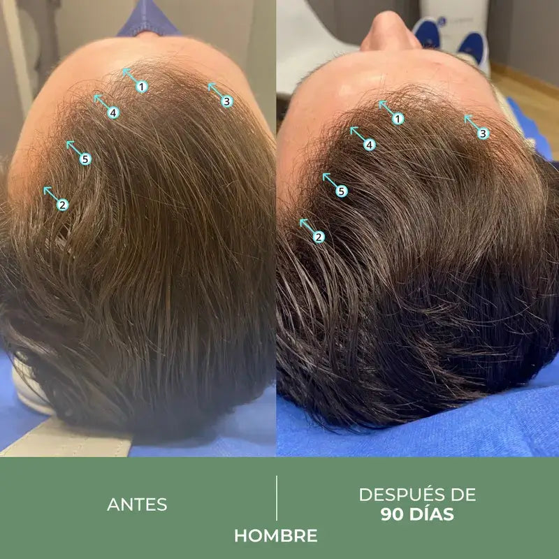 Ds Laboratories Revita Cbd Antioxidant & Stimulating Anti-Hair Loss Shampoo, 205 ml