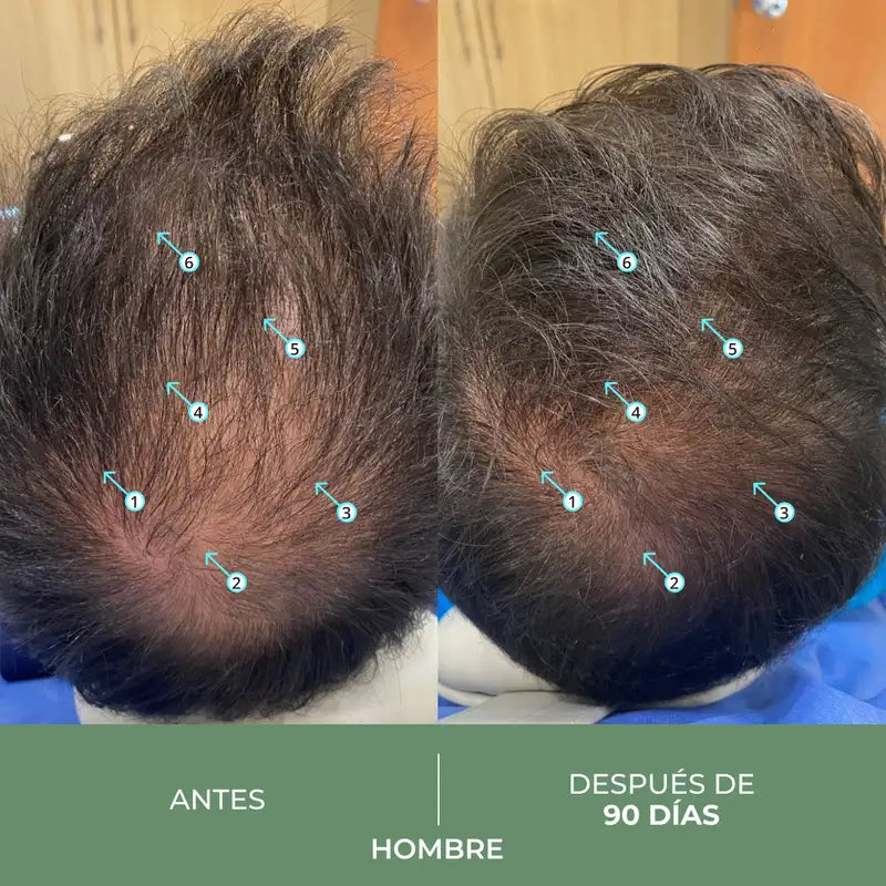 Ds Laboratories Revita Cbd Antioxidant & Stimulating Anti-Hair Loss Shampoo, 205 ml