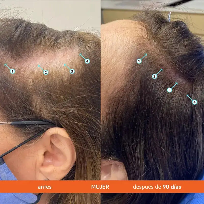 Ds Laboratories REVITA Hair Loss Stimulating Shampoo 925ML