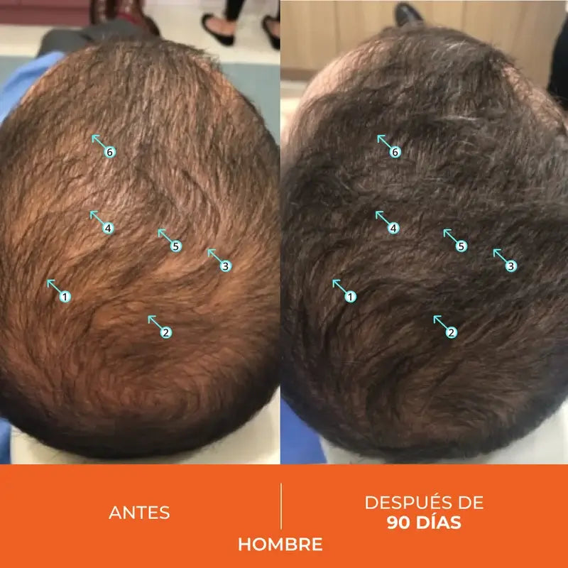 Ds Laboratories Revita Anti-Hair Loss Tablets, 90 pc