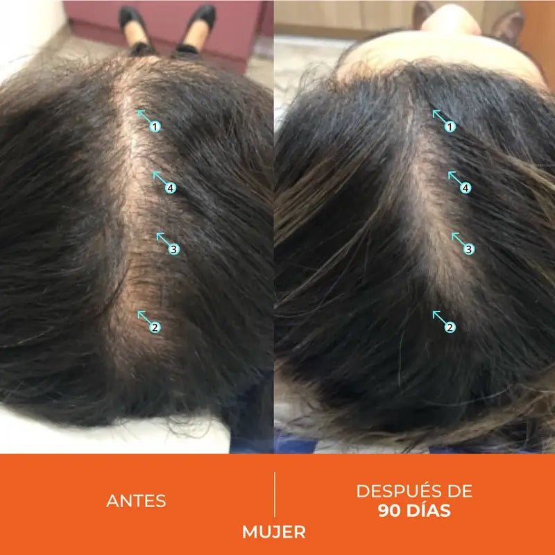 Ds Laboratories Revita Anti-Hair Loss Tablets, 90 pc