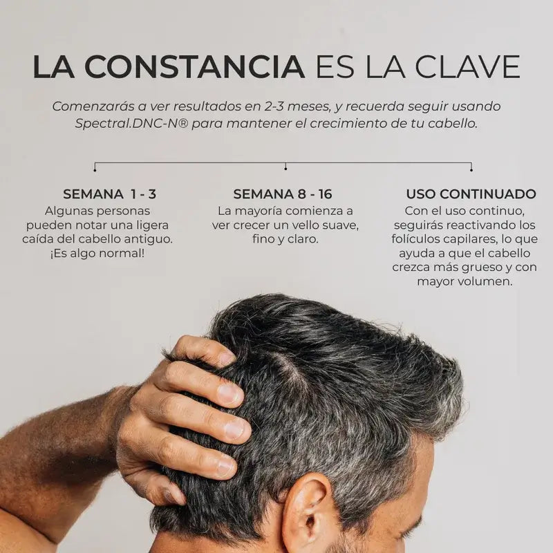 Ds Laboratories Spectral Lotion Dnc-N 3 Months Treatment With Nanoxidil® 5% Hair Loss, 180 ml