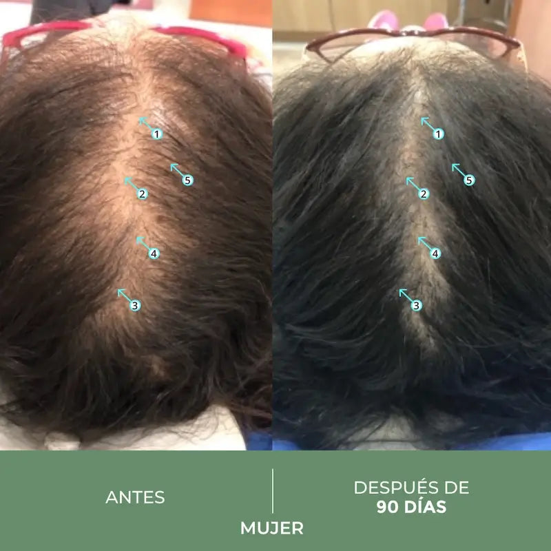 Ds Laboratories Spectral Cbd Hair Loss Lotion, 60 ml