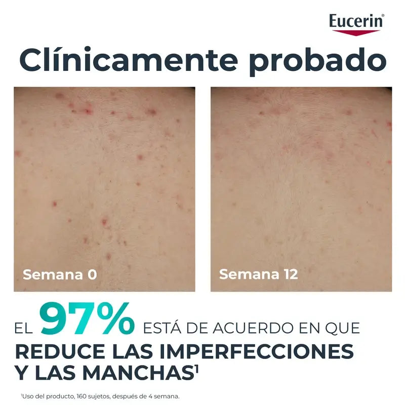 Eucerin Dermopure Triple Effect Body Cream, 200Ml