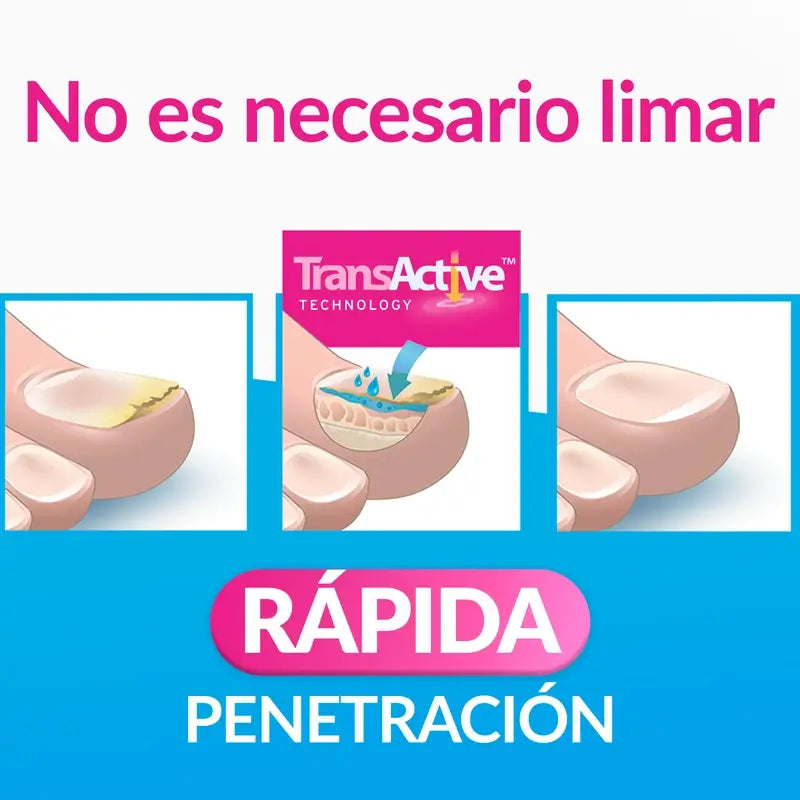 Excilor Nail Enamel Mycosis Treatment, 3.3 ml