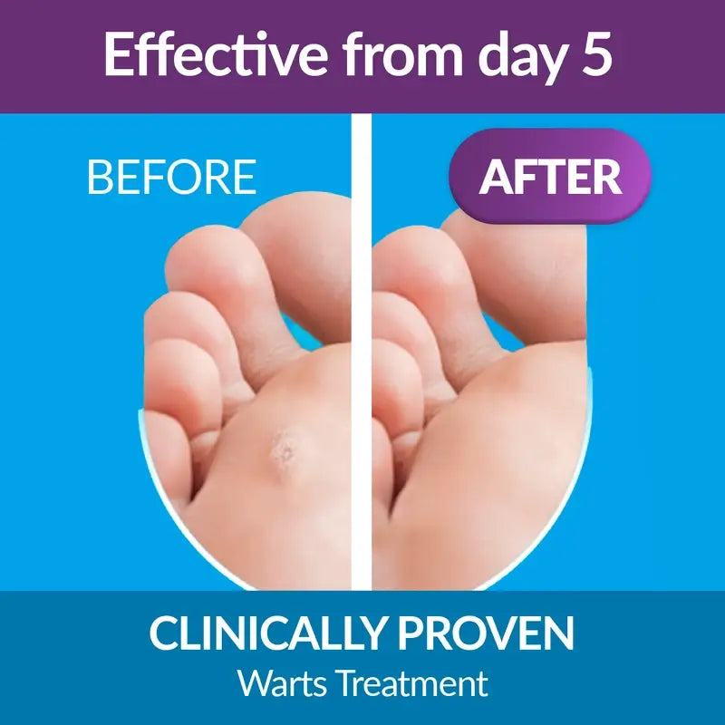 Excilor Pen Nail Mycosis Treatment, 3.3 ml