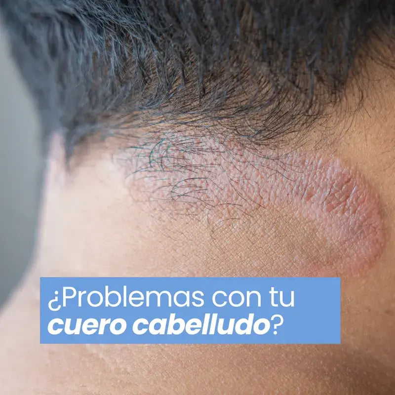 Green Cornerss Pea Shampoo, 300ml