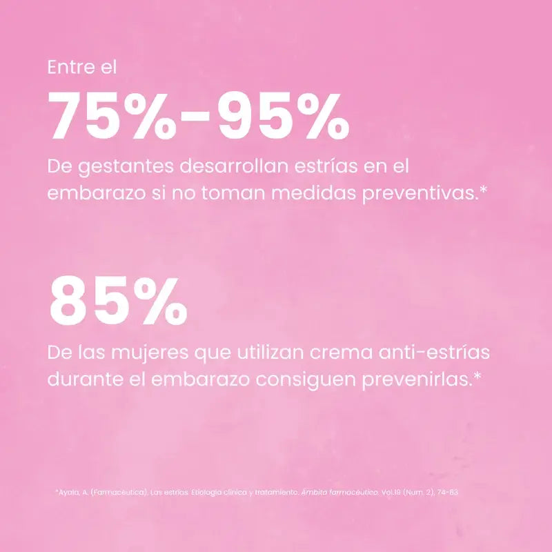 Green Cornerss Dragon's Blood Anti Stretch Mark Cream, 200 ml