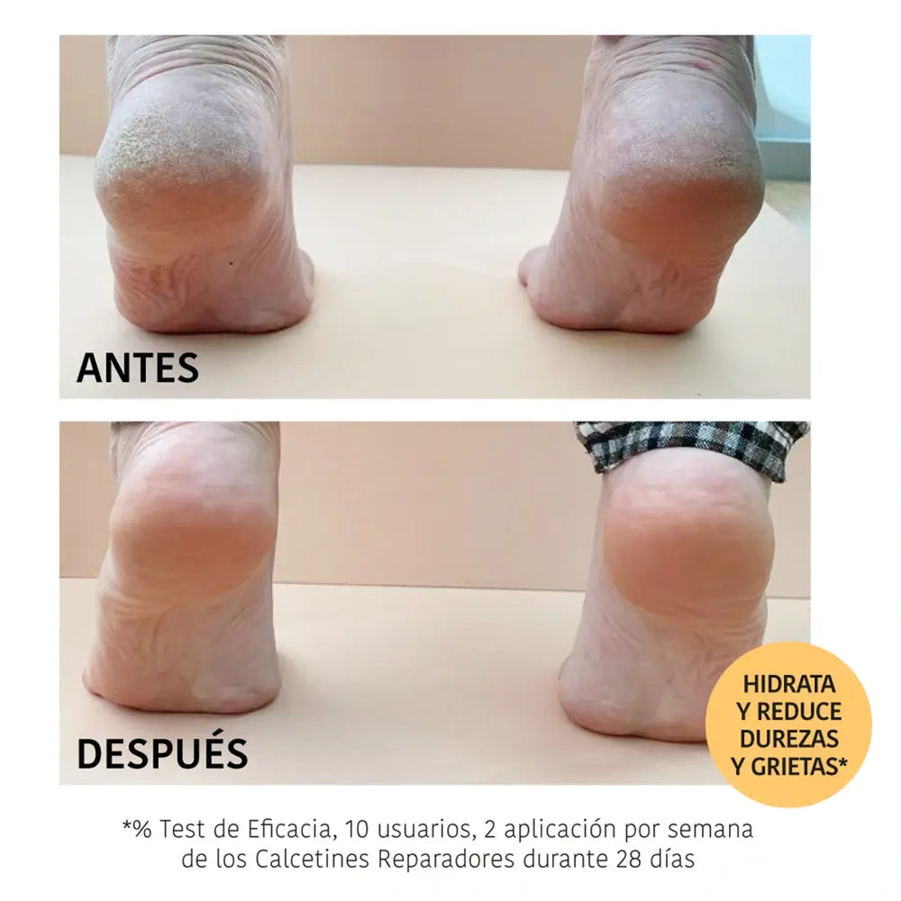 Iroha Nature Body Repairing Socks Mask, 20 Ml