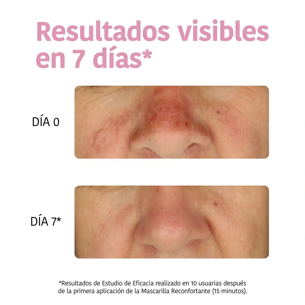 Iroha Nature Moisturising Face Tissue Mask - Aloe Vera , 20 ml