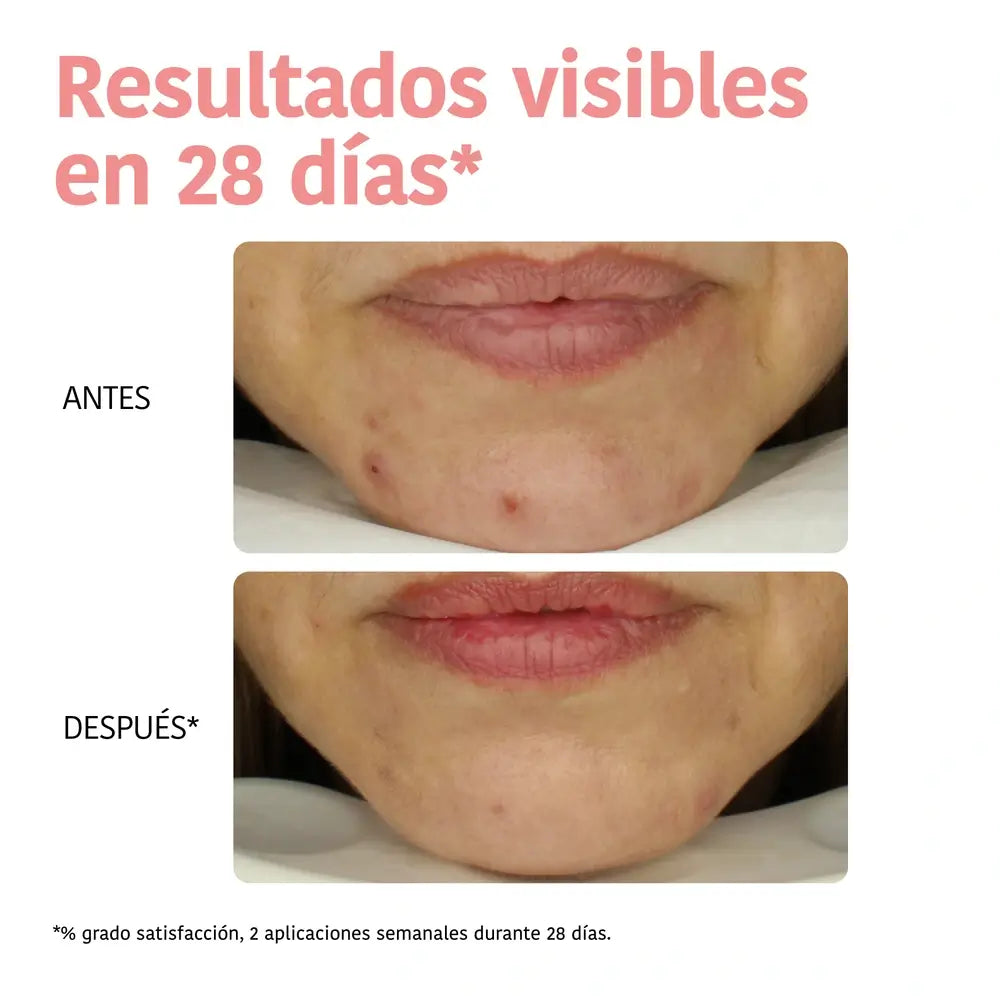 Iroha Nature Facial Peeling Tissue Mask - Glycolic Acid, 23 ml