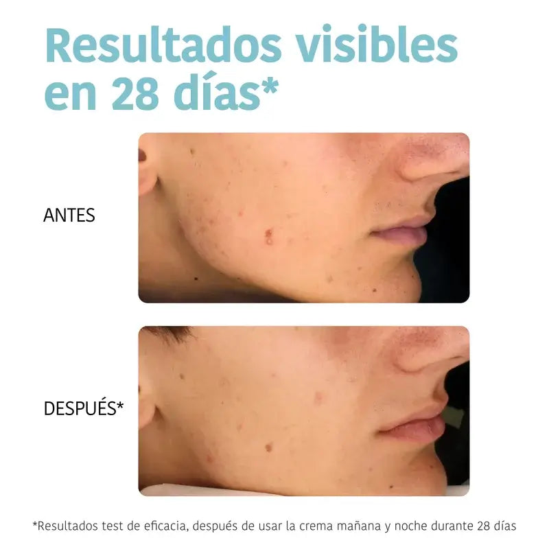 Iroha Nature Oily Skin Anti-imperfection Seboregulating Cream , 50 ml