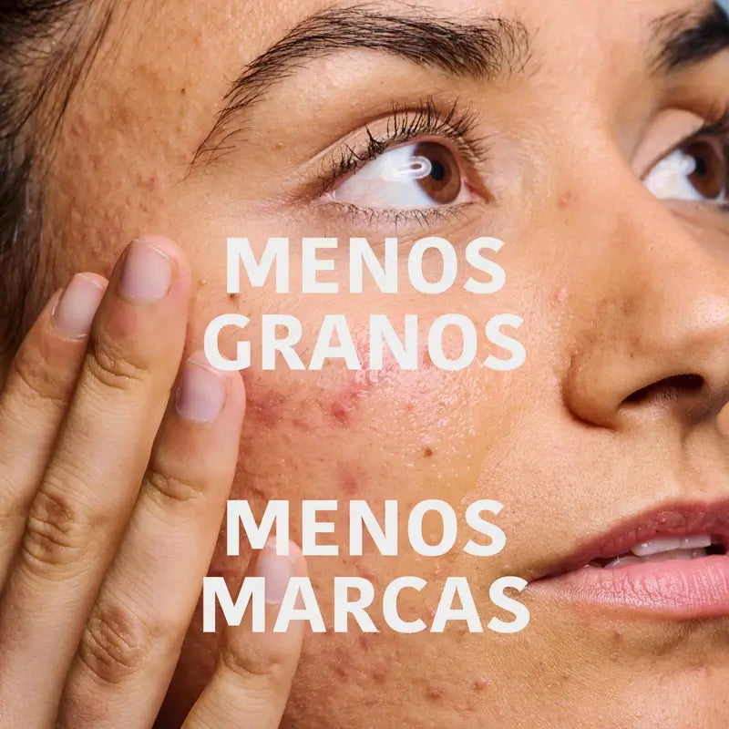 Iroha Nature Oily Skin Anti-Imperfection Serum, 30 ml