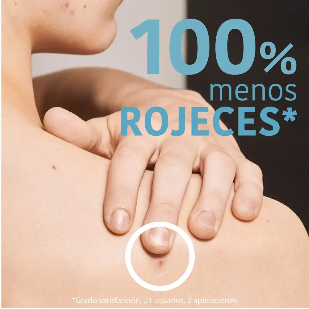 Iroha Nature Sos Pimples Patches - Salicylic Acid, 18 pcs.