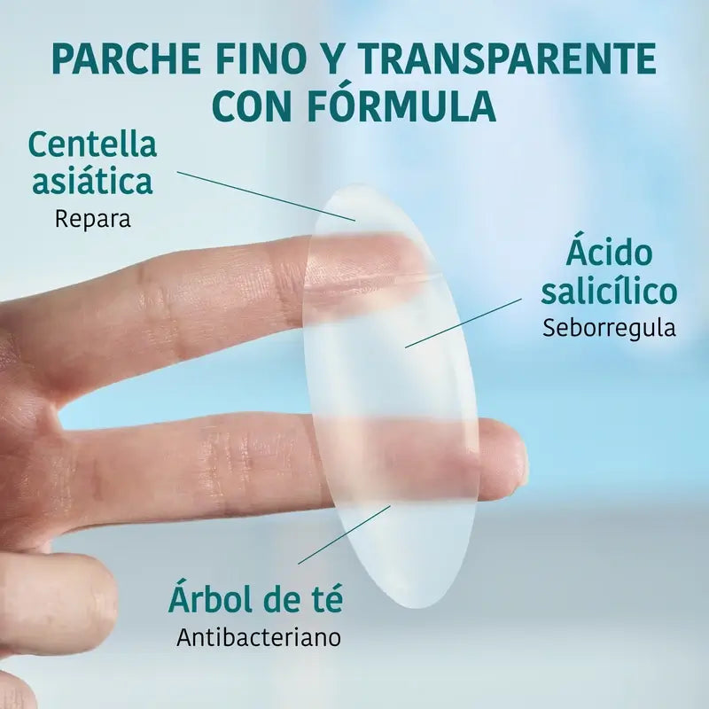 Iroha Nature Xl Pimple Patch , 5 units