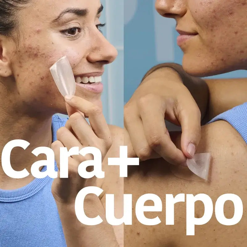 Iroha Nature Xl Pimple Patch , 5 units