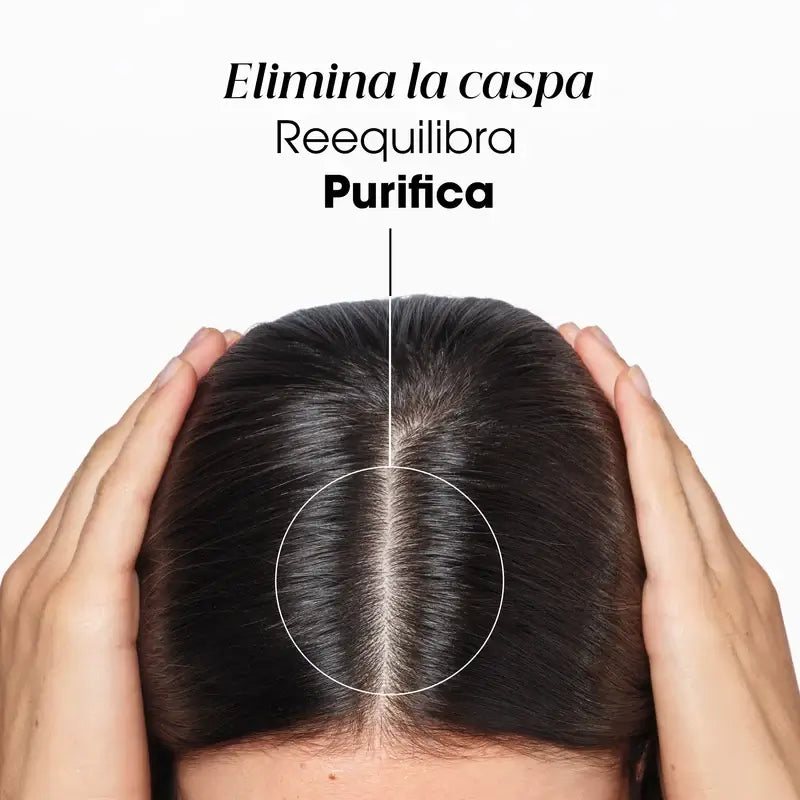 Klorane Anti-Dandruff Rebalancing Treatment Shampoo A La Galanga, 400 ml