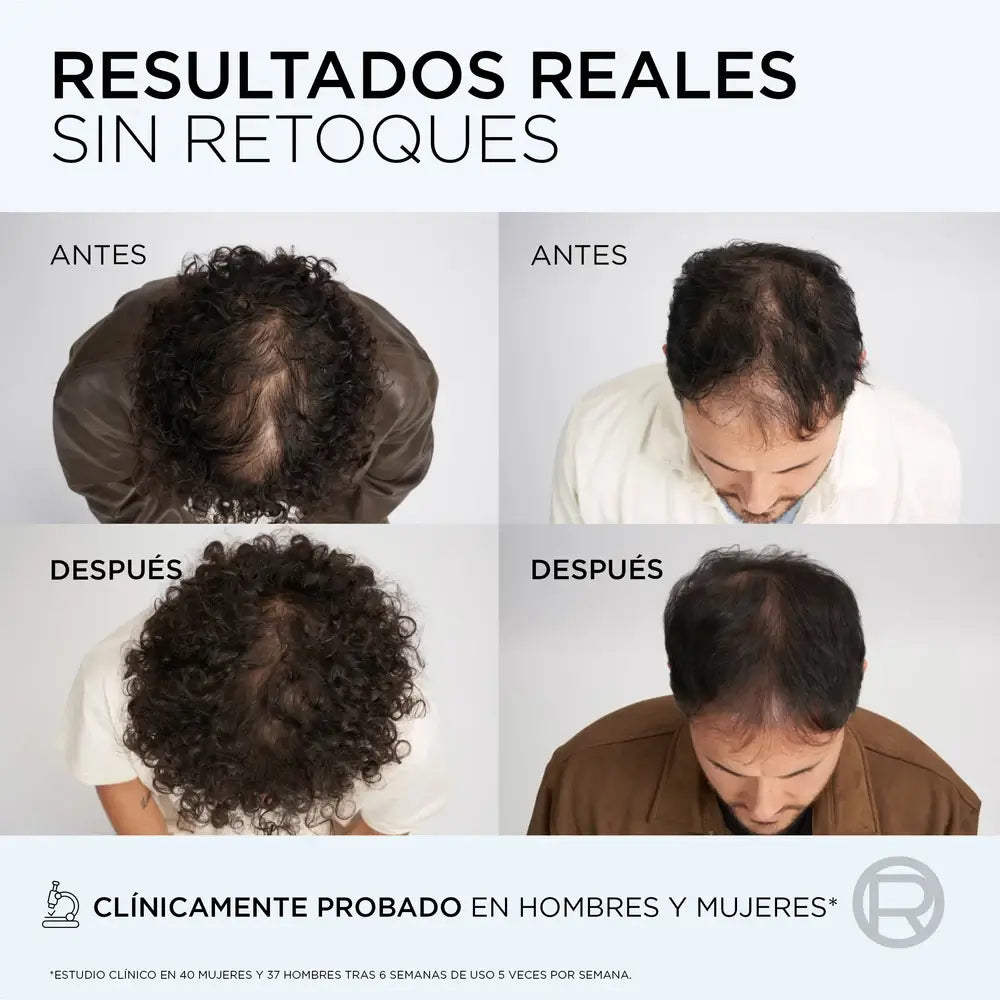 L'Oreal Paris Elvive Anti-Hair Loss Growth Booster Conditioner , 150 ml