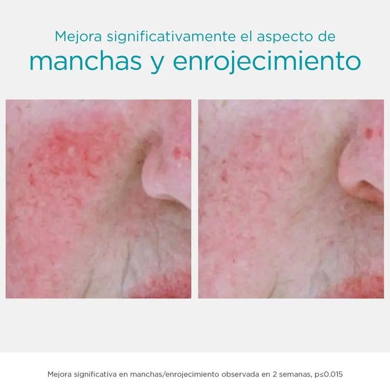 Neostrata Restore Anti-Ageing Facial Serum Anti-Darkness and Anti-Blemish, 29 g