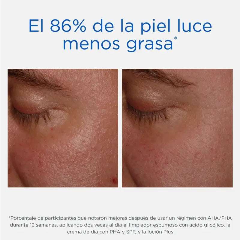 Neostrata Lotion Plus body and face moisturising cream with 15% AHA 200ml