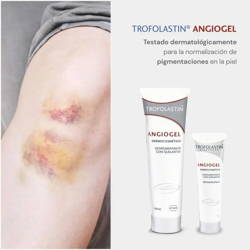 Trofolastin Angiogel Depigmenting Cream 100 Ml