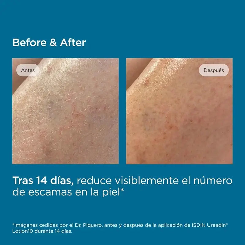 Isdin Ureadin Lotion 1000 Ml