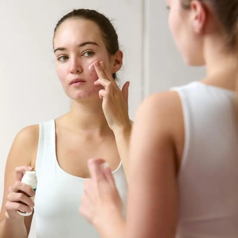 Vincobiosis Dermo-balancing Facial Cremigel , 50 ml